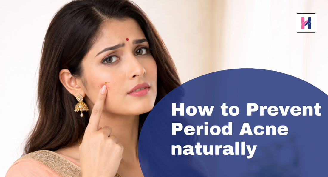Prevent Period Acne naturally
