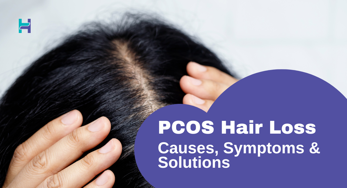 pcos hair loss symptoms and remedies