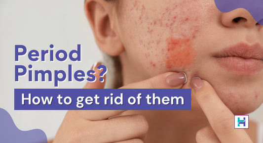 how to get rid of period pimples